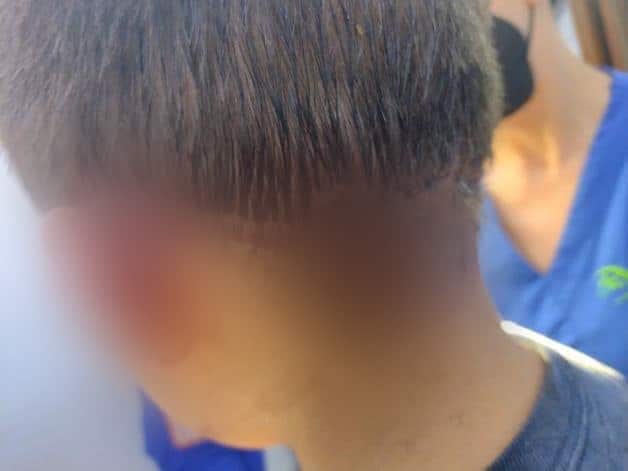 animal agresivo., ataque, colonia Jaripillo, dueño, heridas, Mazatlán, niño, Pitbull, sanciones