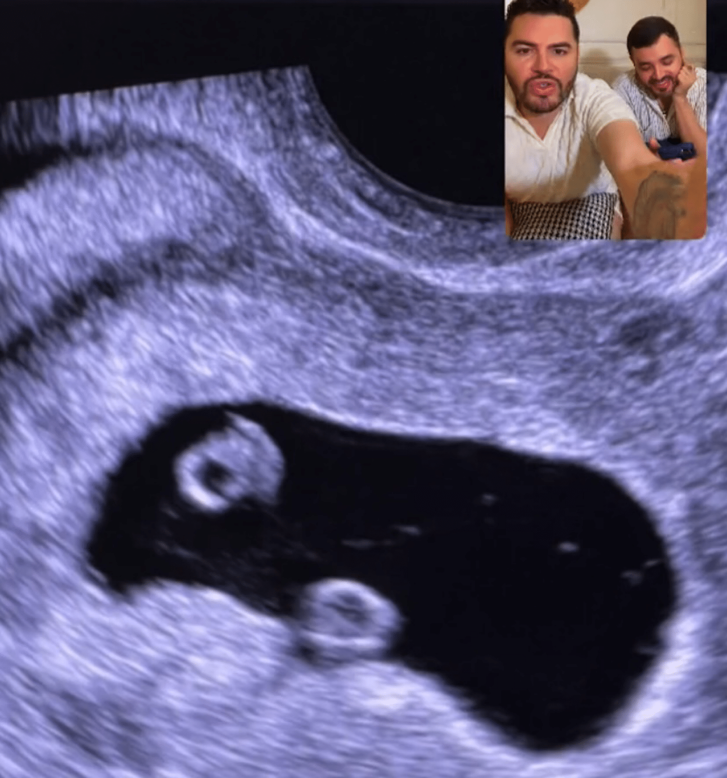 inseminación artificial, lgbt, Pareja