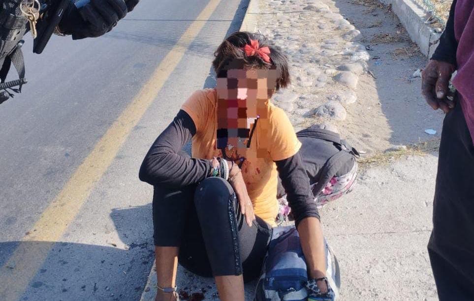 atropellada, Mazatlán, mujer