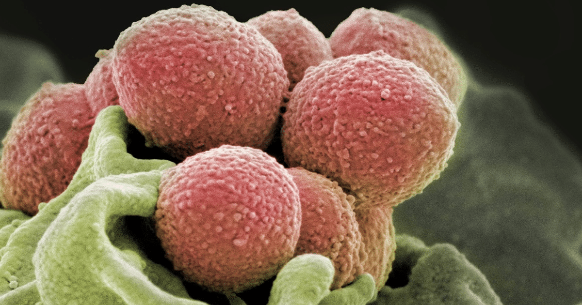 Alerta salud, sintomas, tratamiento