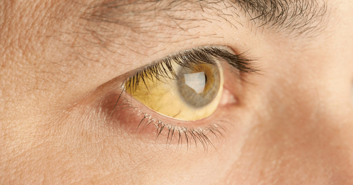 Alerta salud, Hepatitis, OMS