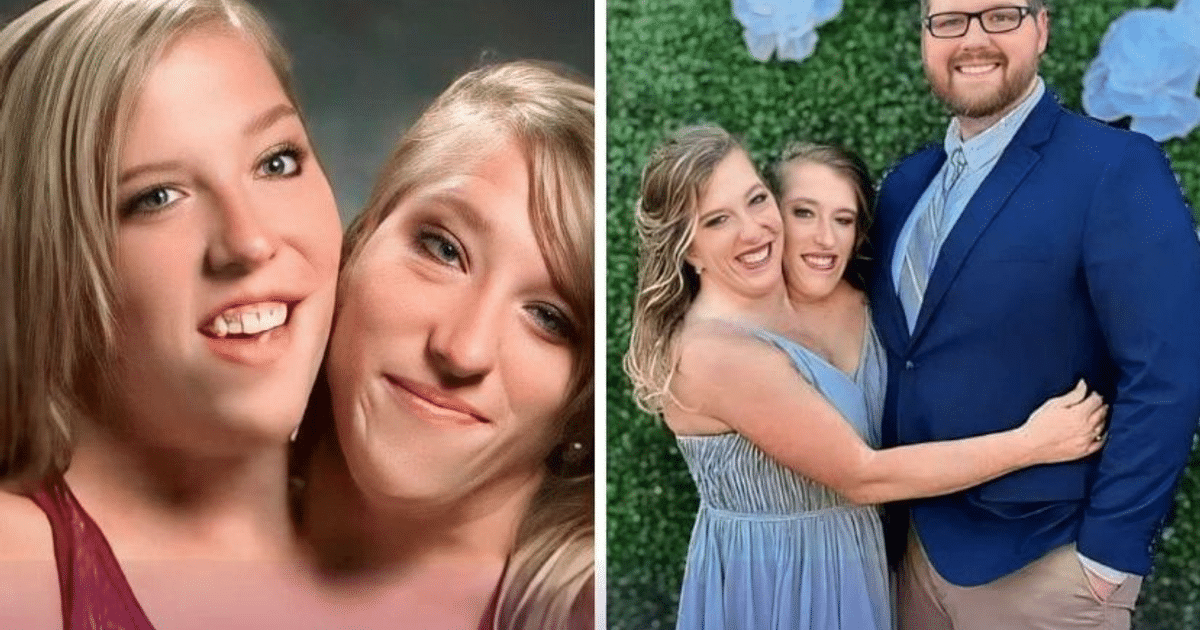 boda, Hermanas Hensel, Siamesas