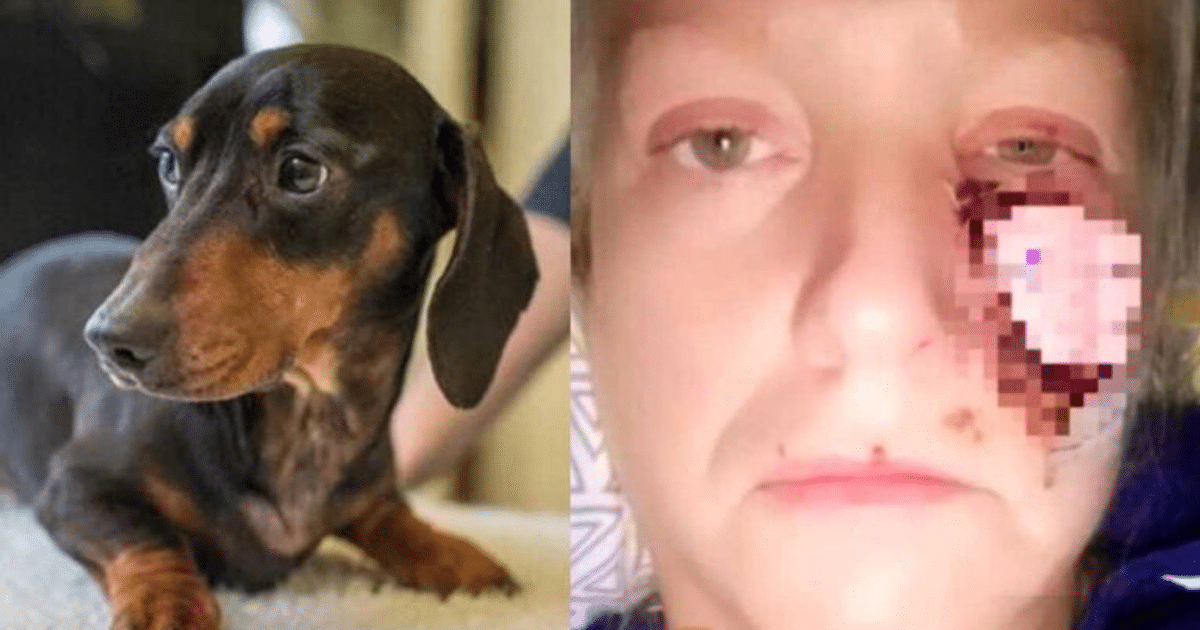 ataque, perro, Reino Unido