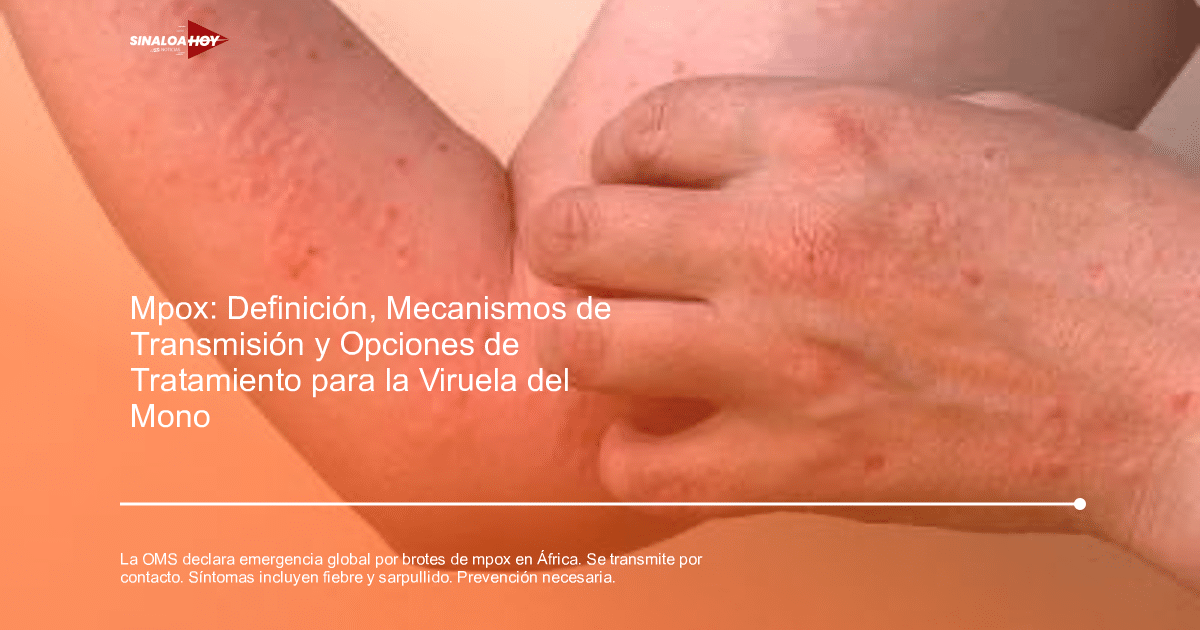 Brote viral., Guardianes de la prevención, mpox, Salud global, Transmisión de enfermedades