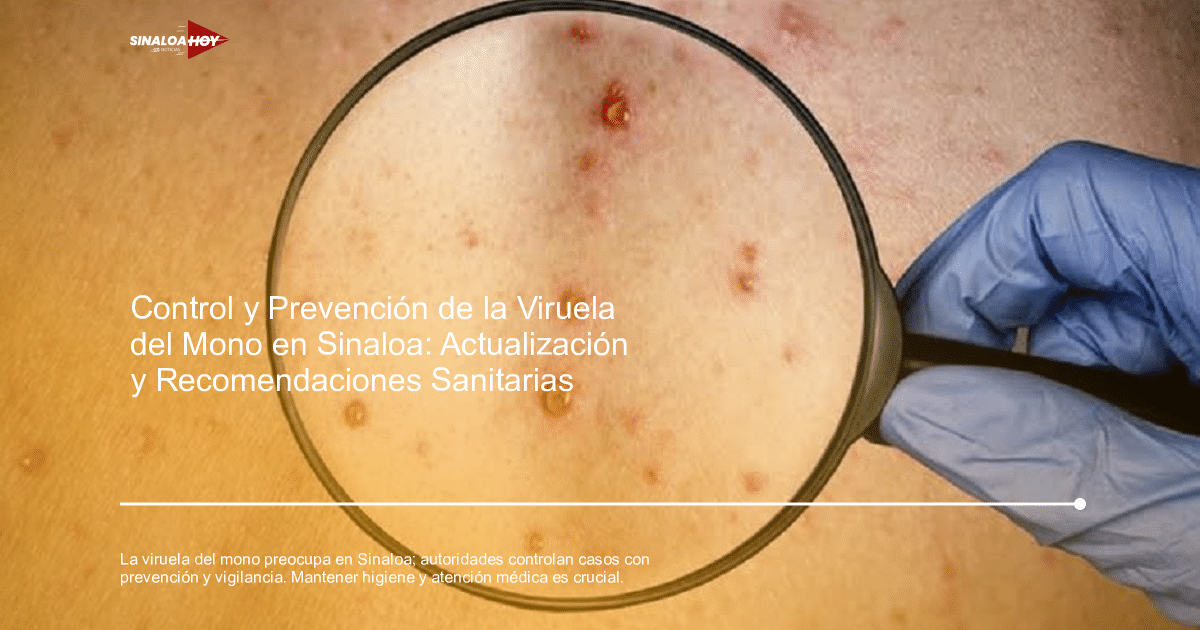 . Sinaloa, Guardianes de la prevención, salud pública, síntomas., viruela del mono