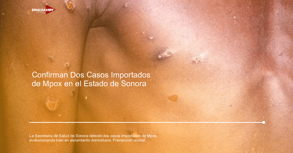 medidas preventivas, mpox, salud pública, Sonora., Vigilancia epidemiológica