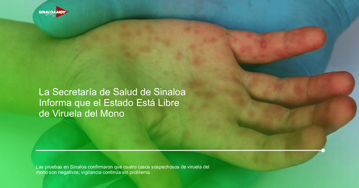 . Sinaloa, Alerta salud, pruebas negativas, Vigilancia epidemiológica, virus del mono