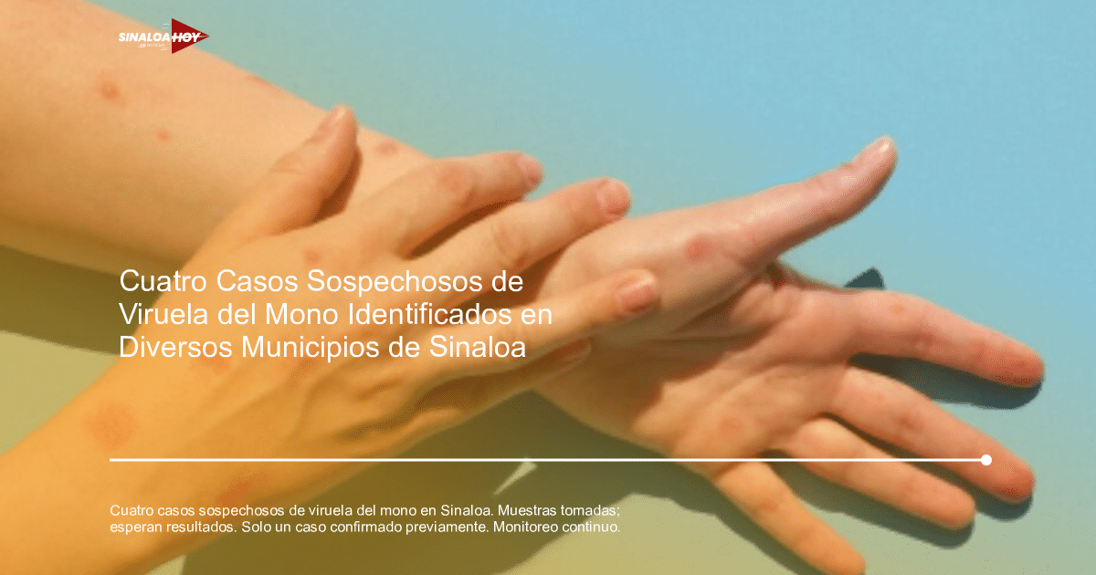 . Sinaloa, Alerta salud, Casos sospechosos, Monitoreo sanitario, viruela del mono
