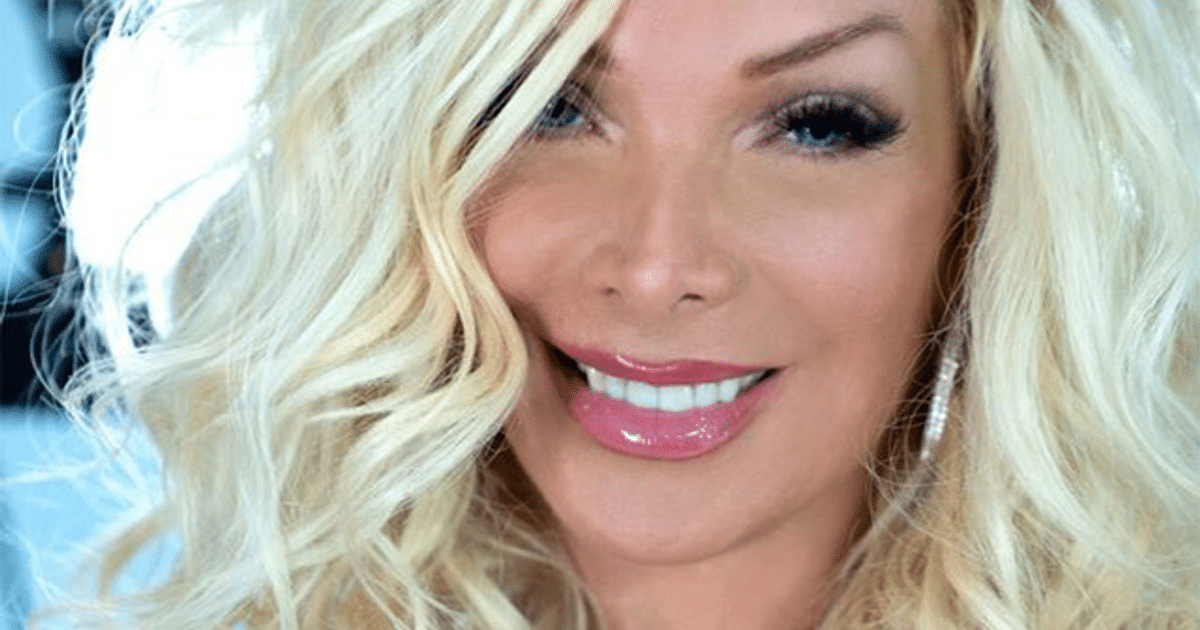 Persona rubia y rizada sonriendo, asociada a la recuperación de Marisela tras cirugía.