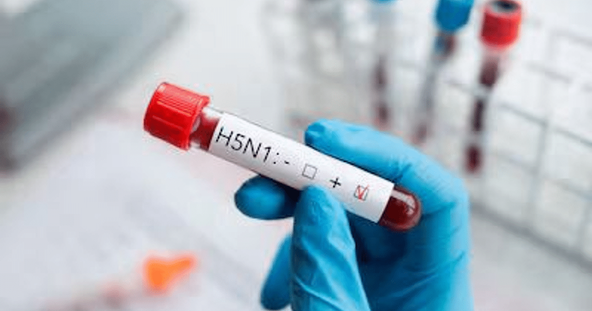 Tubo de ensayo con muestra de sangre etiquetada para H5N1, sostenido por mano enguantada, con fondo de laboratorio.