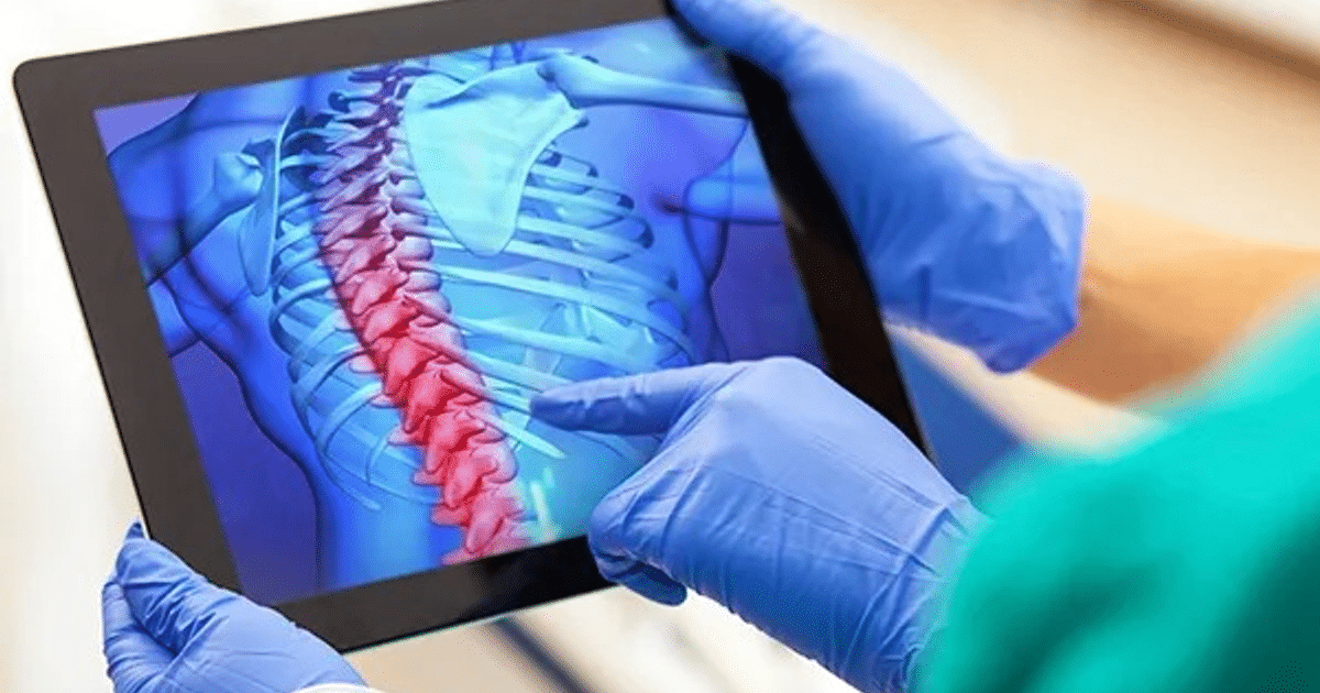 Persona con guantes de látex sosteniendo una tableta que muestra una ilustración de la columna vertebral con áreas rojas destacadas.