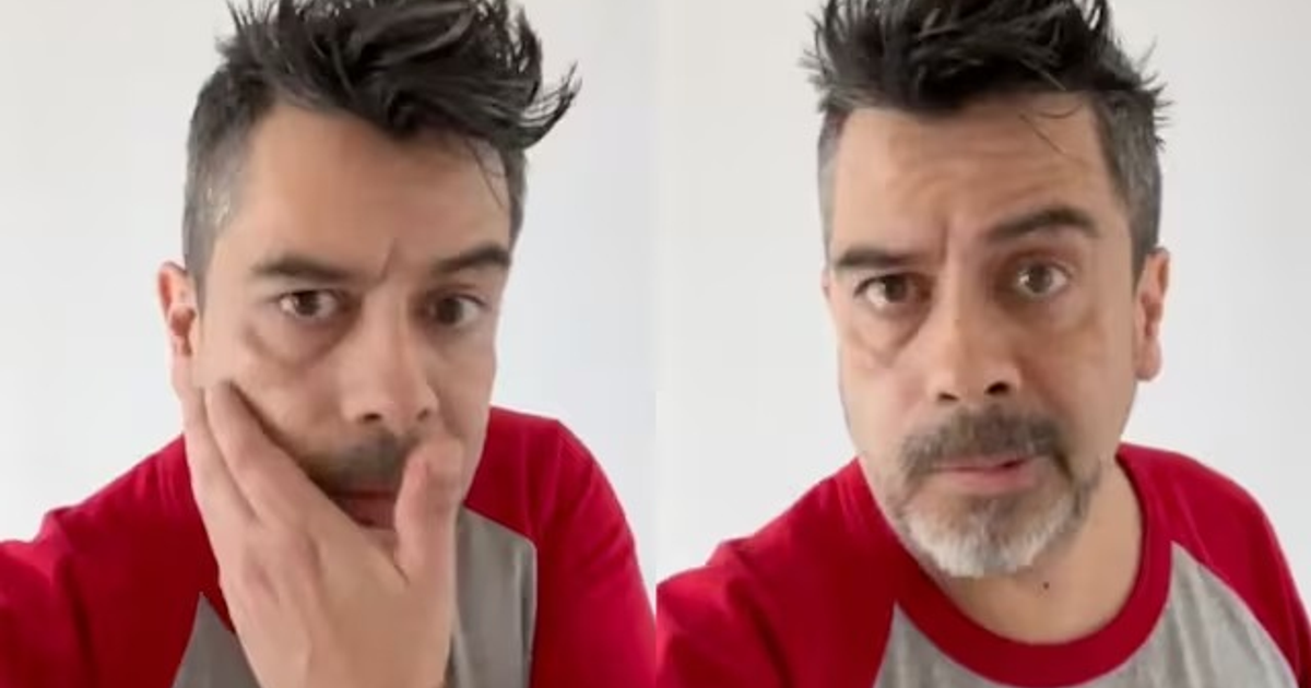 Hombre con cabello desordenado y camiseta roja y gris, relacionado con parálisis facial de Carlos Espejel.