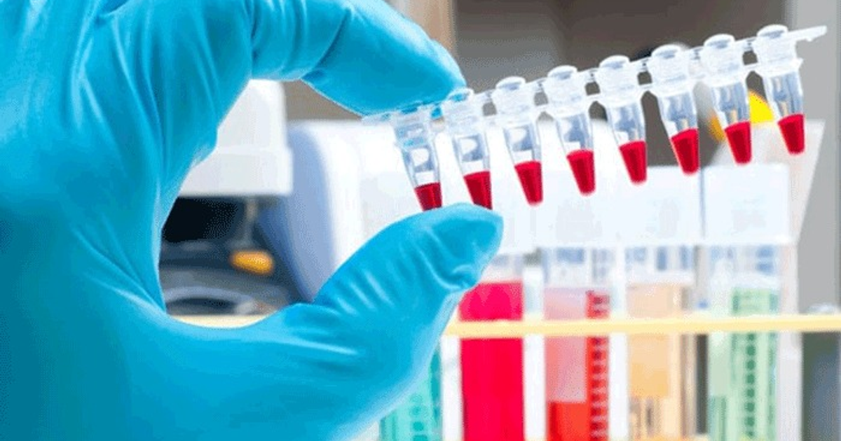 Mano con guante azul sosteniendo tubos de ensayo en laboratorio de pruebas toxicológicas