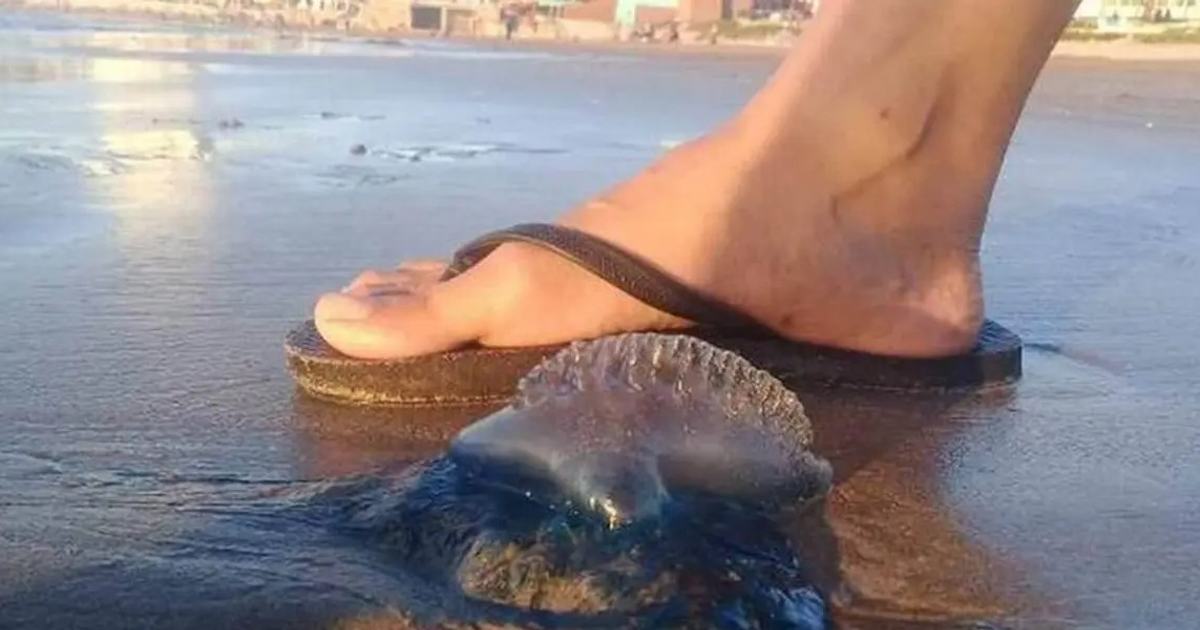 Pie descalzo junto a una medusa azulada en la playa de Mazatlán, destacando la alerta por quemadores.