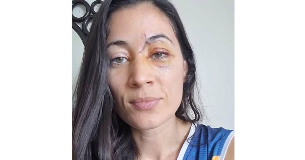 Persona con herida facial tras accidente en ciclovía con scooter eléctrico