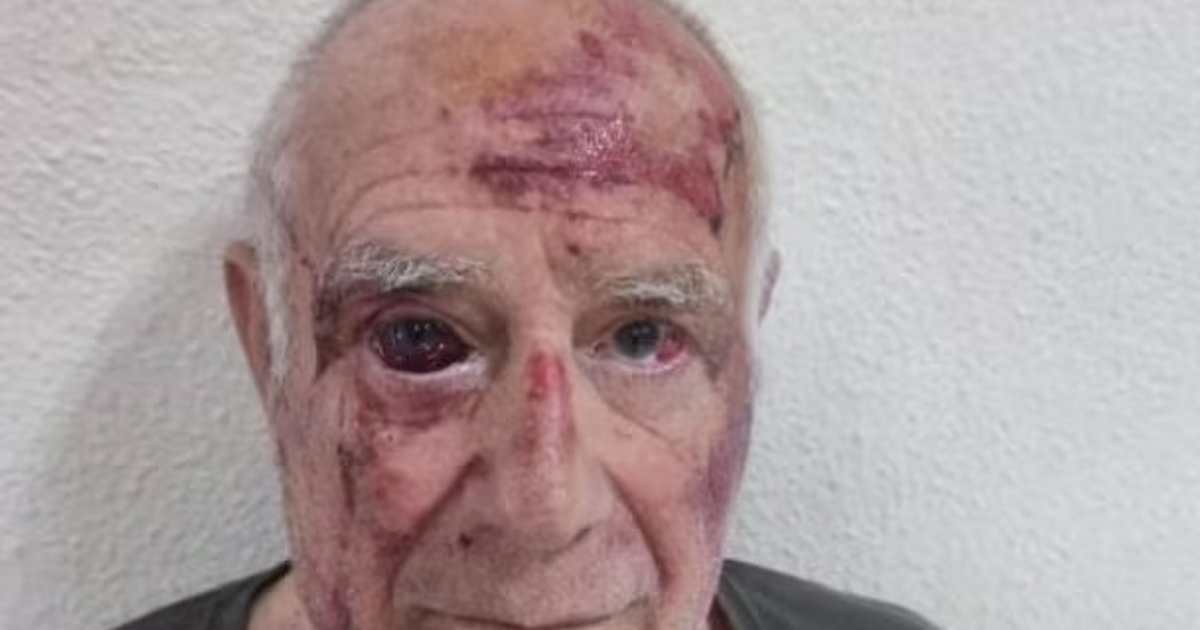 Hombre de 70 años agredido en Torre Pacheco por reto viral