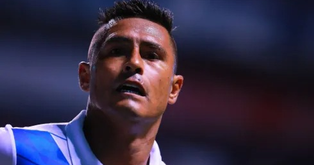 Osvaldo Martínez con esclerodermia localizada en el rostro