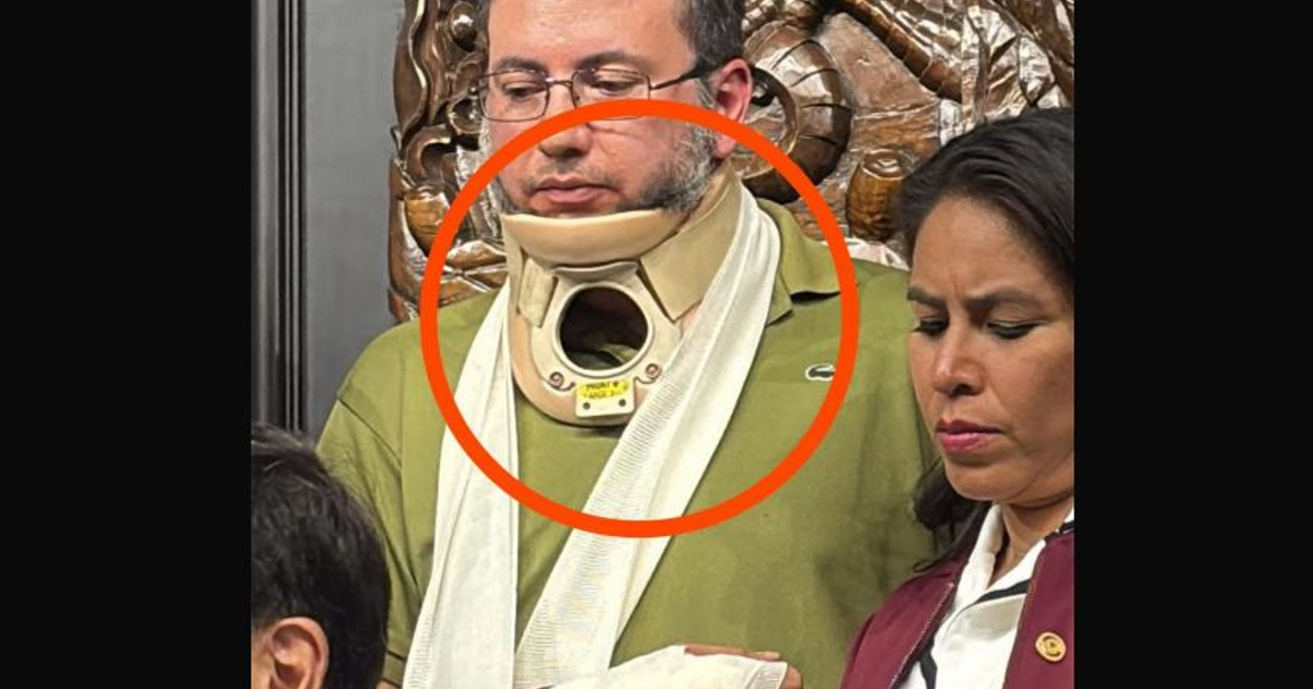 Emiliano González con collarín y vendaje en evento formal