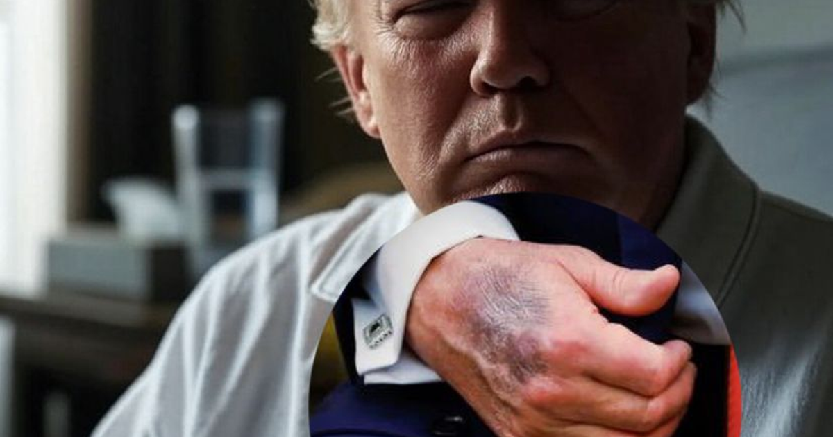 Donald Trump ausente de la vida pública durante 5 días, generando especulaciones en redes sociales.