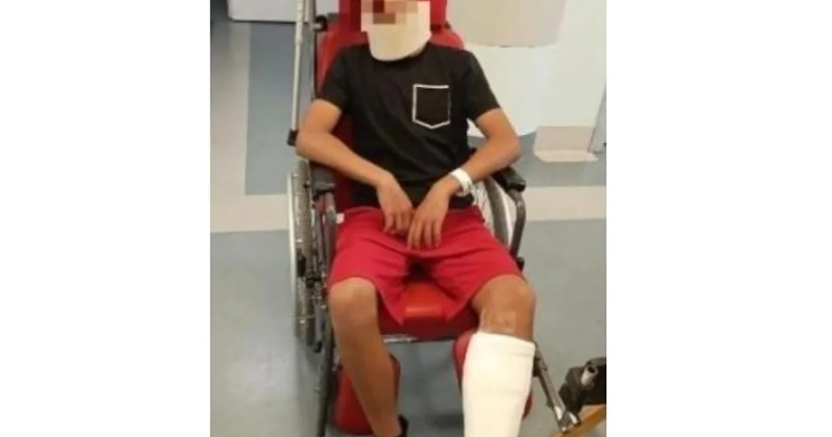 Portero de 13 años en silla de ruedas con vendajes tras agresión en partido de fútbol en Italia