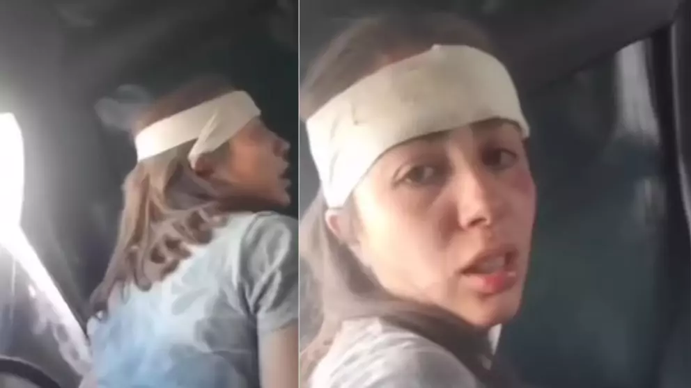 abuso Policial, agresion, CDMX, lesionada, Marcha