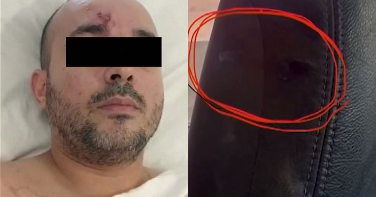 Bianco Lezama, víctima de un retén falso, busca apoyo para operación médica