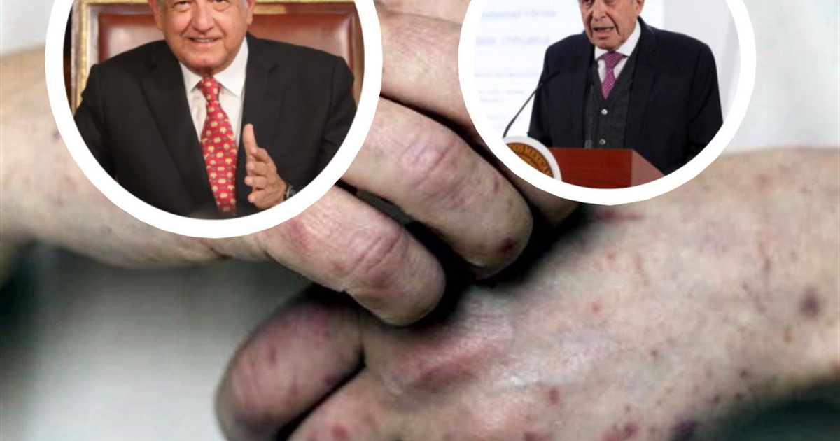 Dos retratos superpuestos y manos entrelazadas con marcas, relacionada al brote de sarampión en México.